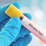 Can Fatty Liver Cause High Bilirubin?