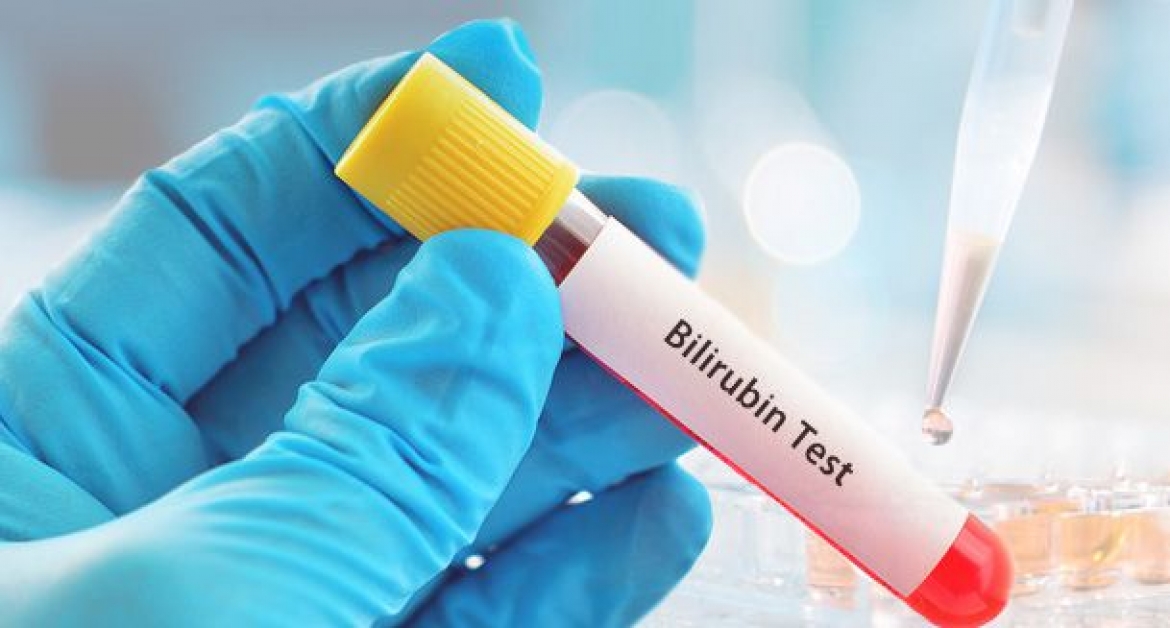 Can Fatty Liver Cause High Bilirubin?