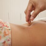 Acupuncture fatty liver